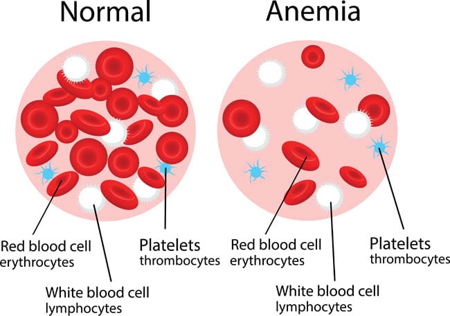 Anemia in cats
