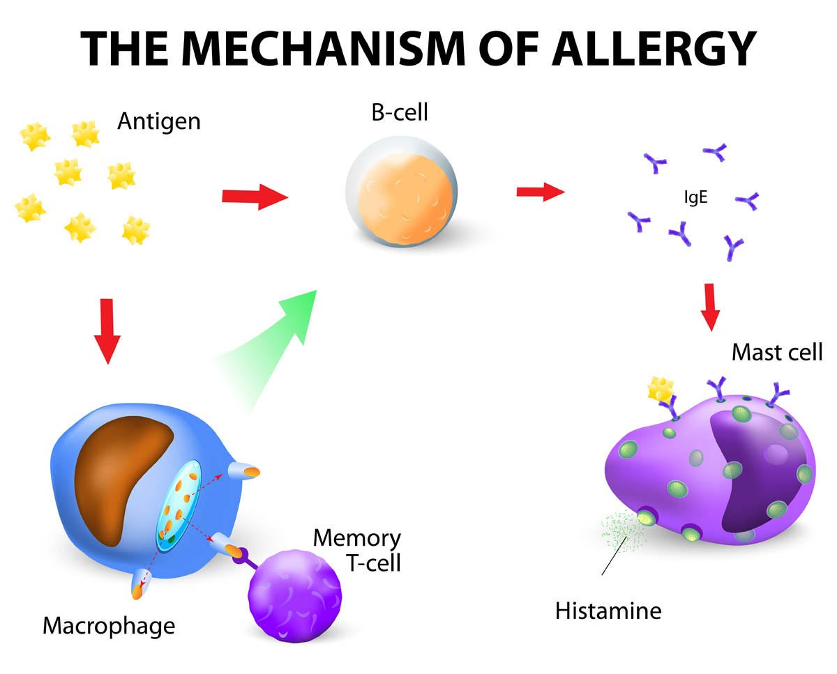 Mechanism of an allergy
