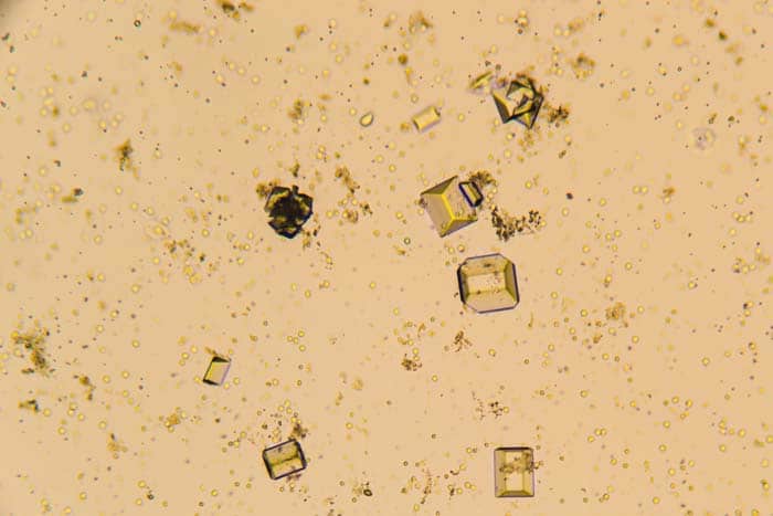 Struvite crystals in a cat urine sample
