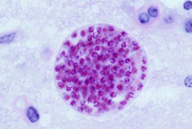 How to Prevent Toxoplasmosis 2 Toxoplasma Gondii cyst in a mouse brain.